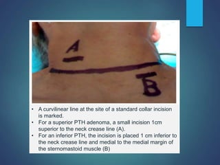 Parathyroid Incision Parathyroid gland anatomy, its disorders and manangement | PPT