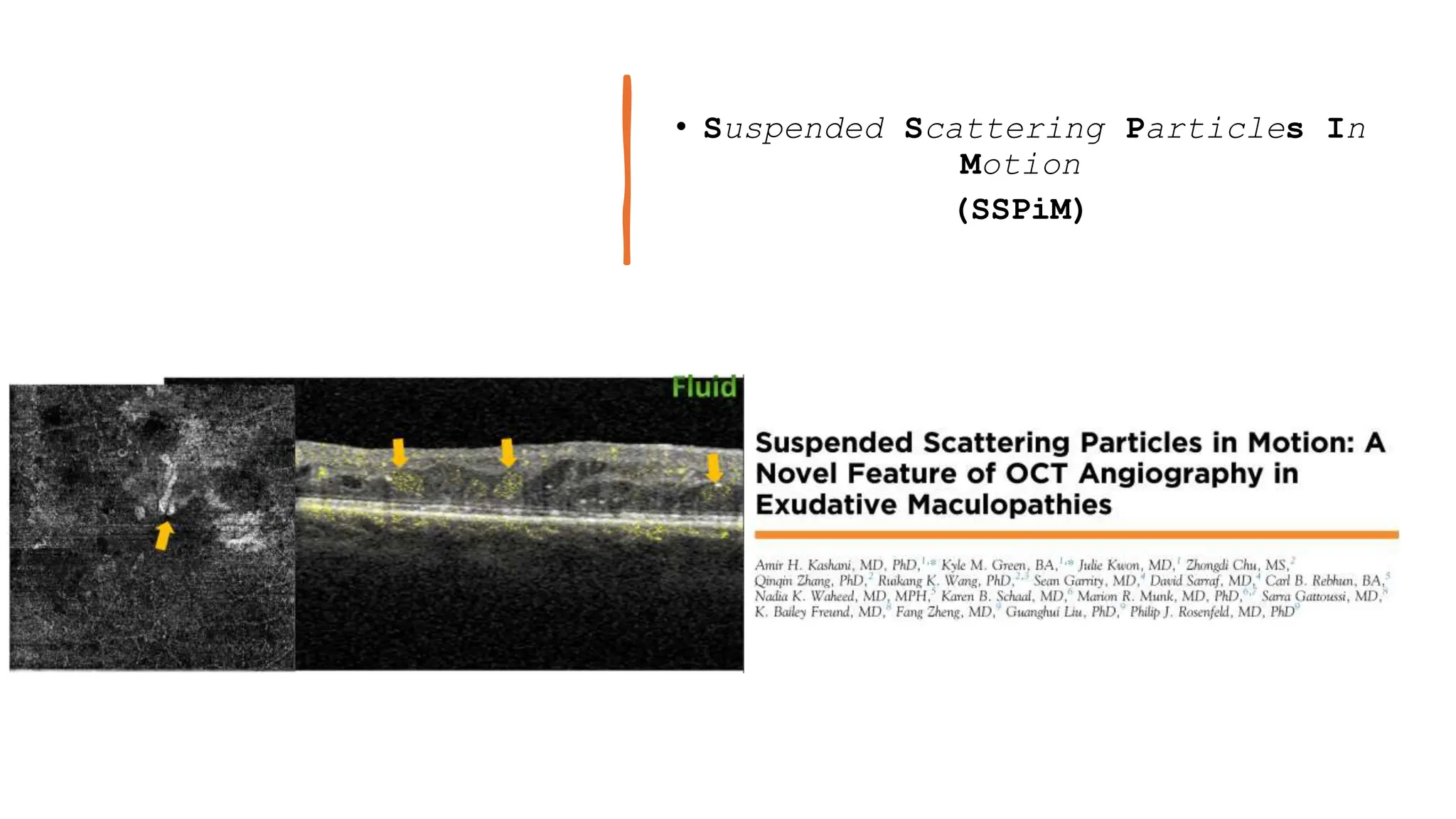 • Suspended Scattering Particles In
Motion
(SSPiM)
 