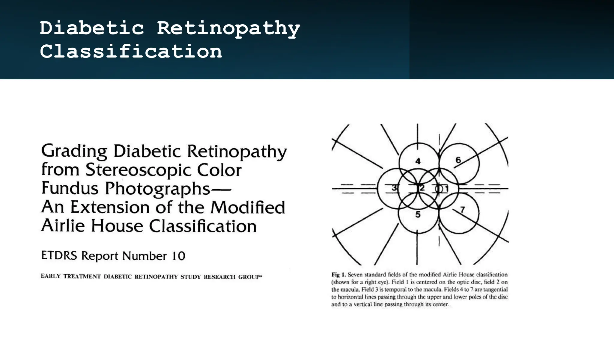 Diabetic Retinopathy
Classification
 