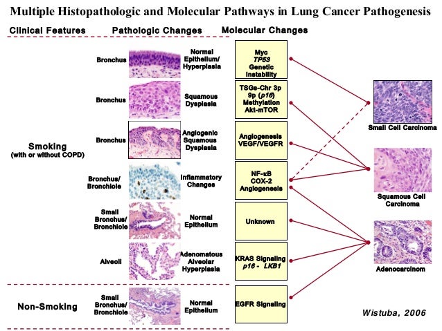 Dr Dinah Parums. The Role of the Pathologist in Targeted Therapy and