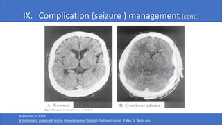 IX. Complication (seizure ) management (cont.)
Published in 2002
A Systematic Approach to the Hyponatremic PatientI. Ratković-Gusić, P. Kes, V. Basić-kes
 