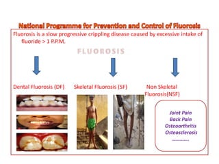 Fluorosis is a slow progressive crippling disease caused by excessive intake of
fluoride > 1 P.P.M.
Dental Fluorosis (DF) Skeletal Fluorosis (SF) Non Skeletal
Fluorosis(NSF)
Joint Pain
Back Pain
Osteoarthritis
Osteosclerosis
………….
 