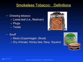 smokeless tobacco definition Dr. Ebbert Spit Tobacco Presentation