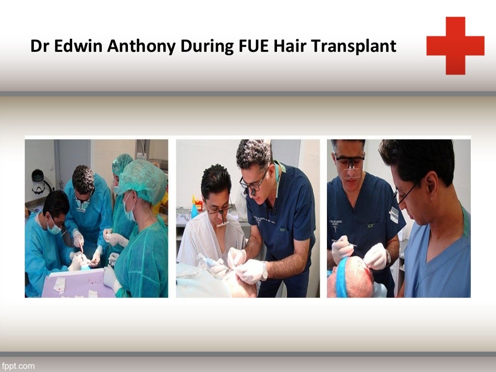 Dr. Edwin Anthony Hair Transplant Surgeon & Cosmetic Doctor