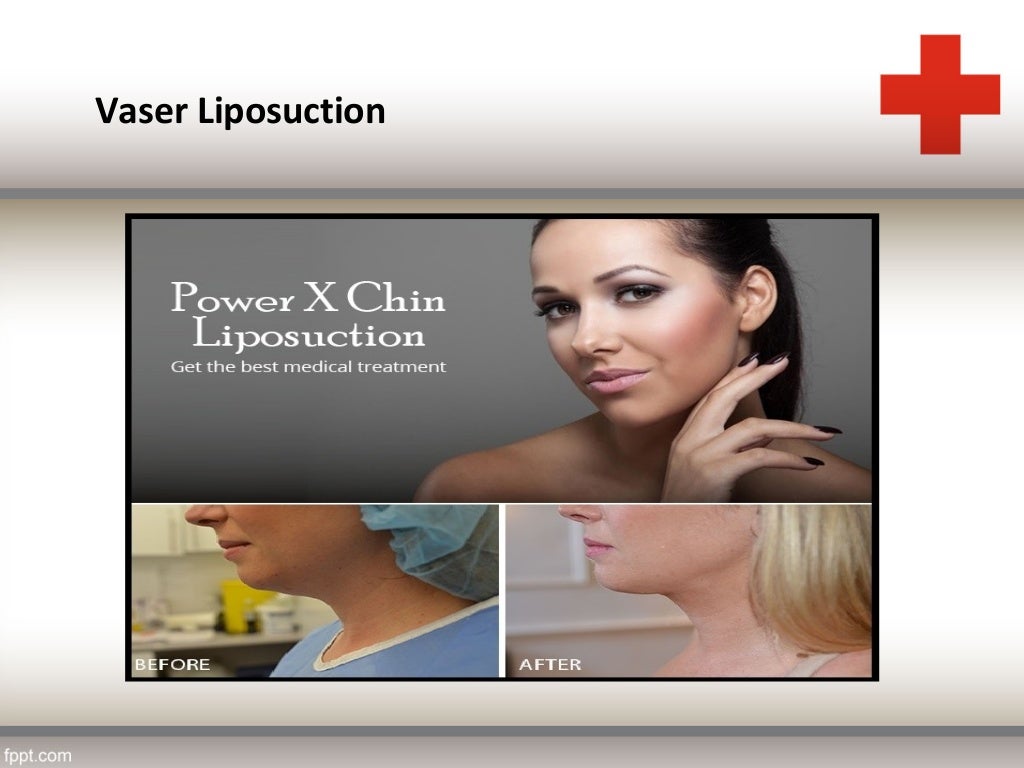 Dr. Edwin Anthony Hair Transplant Surgeon & Cosmetic Doctor