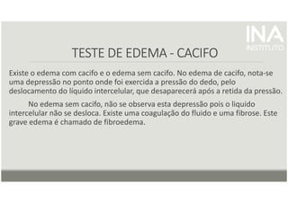 TESTE DE EDEMA
TESTE DE EDEMA
TESTE DE EDEMA
TESTE DE EDEMA -
-
-
- CACIFO
CACIFO
CACIFO
CACIFO
Existe o edema com cacifo e o edema sem cacifo. No edema de cacifo, nota-se
uma depressão no ponto onde foi exercida a pressão do dedo, pelo
deslocamento do líquido intercelular, que desaparecerá após a retida da pressão.
No edema sem cacifo, não se observa esta depressão pois o liquido
intercelular não se desloca. Existe uma coagulação do fluido e uma fibrose. Este
grave edema é chamado de fibroedema.
 
