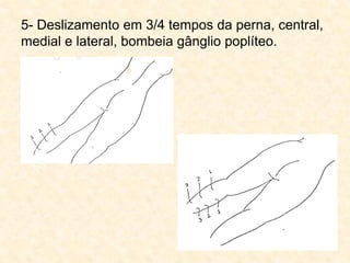 5- Deslizamento em 3/4 tempos da perna, central,
medial e lateral, bombeia gânglio poplíteo.
 