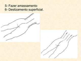 5- Fazer amassamento
6- Deslizamento superficial.
 