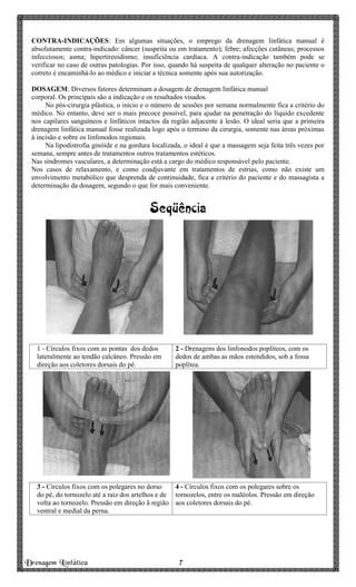 Drenagem Linfática 7777
CONTRA-INDICAÇÕES: Em algumas situações, o emprego da drenagem linfática manual é
absolutamente contra-indicado: câncer (suspeita ou em tratamento); febre; afecções cutâneas; processos
infecciosos; asma; hipertireoidismo; insuficiência cardíaca. A contra-indicação também pode se
verificar no caso de outras patologias. Por isso, quando há suspeita de qualquer alteração no paciente o
correto é encaminhá-lo ao médico e iniciar a técnica somente após sua autorização.
DOSAGEM: Diversos fatores determinam a dosagem de drenagem linfática manual
corporal. Os principais são a indicação e os resultados visados.
No pós-cirurgia plástica, o início e o número de sessões por semana normalmente fica a critério do
médico. No entanto, deve ser o mais precoce possível, para ajudar na penetração do líquido excedente
nos capilares sanguíneos e linfáticos intactos da região adjacente à lesão. O ideal seria que a primeira
drenagem linfática manual fosse realizada logo após o termino da cirurgia, somente nas áreas próximas
à incisão e sobre os linfonodos regionais.
Na lipodistrofia ginóide e na gordura localizada, o ideal é que a massagem seja feita três vezes por
semana, sempre antes de tratamentos outros tratamentos estéticos.
Nas síndromes vasculares, a determinação está a cargo do médico responsável pelo paciente.
Nos casos de relaxamento, e como coadjuvante em tratamentos de estrias, como não existe um
envolvimento metabólico que desprenda de continuidade, fica a critério do paciente e do massagista a
determinação da dosagem, segundo o que for mais conveniente.
Seqüência
1 - Círculos fixos com as pontas dos dedos
lateralmente ao tendão calcâneo. Pressão em
direção aos coletores dorsais do pé.
2 - Drenagens dos linfonodos poplíteos, com os
dedos de ambas as mãos estendidos, sob a fossa
poplítea.
3 - Círculos fixos com os polegares no dorso
do pé, do tornozelo até a raiz dos artelhos e de
volta ao tornozelo. Pressão em direção ã região
ventral e medial da perna.
4 - Círculos fixos com os polegares sobre os
tornozelos, entre os maléolos. Pressão em direção
aos coletores dorsais do pé.
 