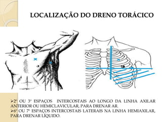 LOCALIZAÇÃO DO DRENO TORÁCICO
2º OU 3º ESPAÇOS INTERCOSTAIS AO LONGO DA LINHA AXILAR
ANTERIOR OU HEMICLAVICULAR, PARA DRENAR AR.
6º OU 7º ESPAÇOS INTERCOSTAIS LATERAIS NA LINHA HEMIAXILAR,
PARA DRENAR LÍQUIDO.
 