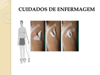 CUIDADOS DE ENFERMAGEM
 