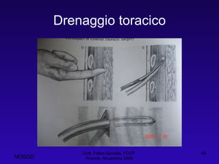 Drenaggio toracico Dott. Felice Apicella, FCCP  Firenze, Novembre 2008 NOSGD 
