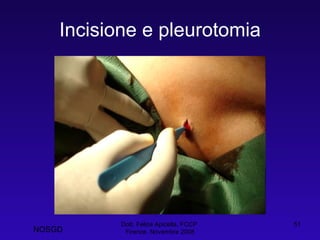 Incisione e pleurotomia Dott. Felice Apicella, FCCP  Firenze, Novembre 2008 NOSGD 