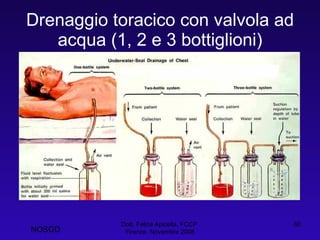 Drenaggio toracico con valvola ad acqua (1, 2 e 3 bottiglioni) Dott. Felice Apicella, FCCP  Firenze, Novembre 2008 NOSGD 