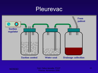Pleurevac Dott. Felice Apicella, FCCP  Firenze, Novembre 2008 NOSGD 