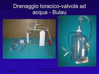 Drenaggio toracico-valvola ad acqua - Bulau Dott. Felice Apicella, FCCP  Firenze, Novembre 2008 NOSGD 