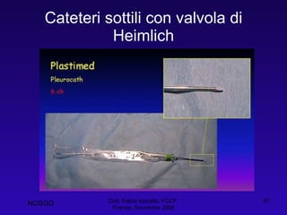 Cateteri sottili con valvola di Heimlich Dott. Felice Apicella, FCCP  Firenze, Novembre 2008 NOSGD 