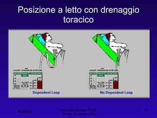 Posizione a letto con drenaggio toracico Dott. Felice Apicella, FCCP  Firenze, Novembre 2008 NOSGD 