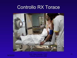 Controllo RX Torace Dott. Felice Apicella, FCCP  Firenze, Novembre 2008 NOSGD 