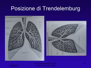 Posizione di Trendelemburg Dott. Felice Apicella, FCCP  Firenze, Novembre 2008 NOSGD 
