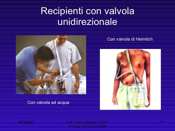 Drenaggio A Caduta O In Aspirazione Il drenaggio toracico