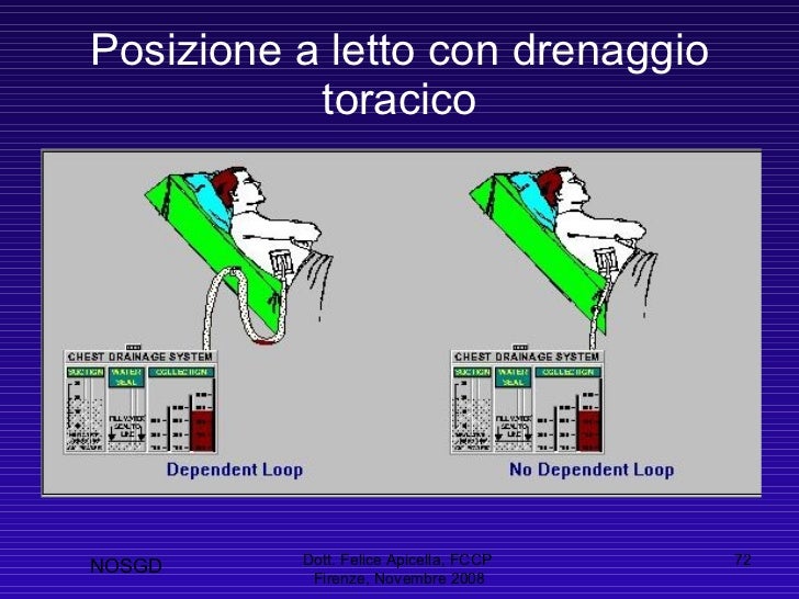 Il drenaggio toracico