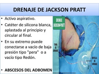 • Activo aspirativo.
• Catéter de silicona blanca,
aplastada al principio y
circular al final.
• En su extremo puede
conectarse a vacío de baja
presión tipo "pera" o a
vacío tipo Redón.
• ABSCESOS DEL ADBOMEN
DRENAJE DE JACKSON PRATT
 