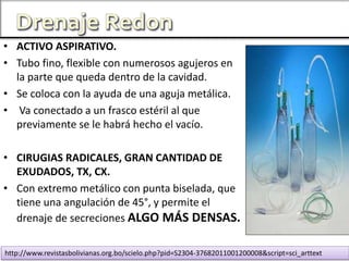 • ACTIVO ASPIRATIVO.
• Tubo fino, flexible con numerosos agujeros en
la parte que queda dentro de la cavidad.
• Se coloca con la ayuda de una aguja metálica.
• Va conectado a un frasco estéril al que
previamente se le habrá hecho el vacío.
• CIRUGIAS RADICALES, GRAN CANTIDAD DE
EXUDADOS, TX, CX.
• Con extremo metálico con punta biselada, que
tiene una angulación de 45°, y permite el
drenaje de secreciones ALGO MÁS DENSAS.
http://www.revistasbolivianas.org.bo/scielo.php?pid=S2304-37682011001200008&script=sci_arttext
 