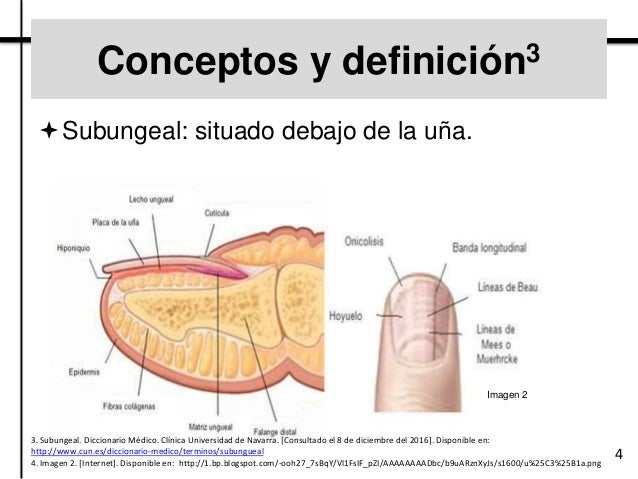 Como sanar la uña después del hongo de las uñas