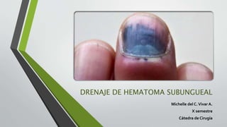 DRENAJE DE HEMATOMA SUBUNGUEAL
Michelle del C.Vivar A.
X semestre
Cátedra de Cirugía
 