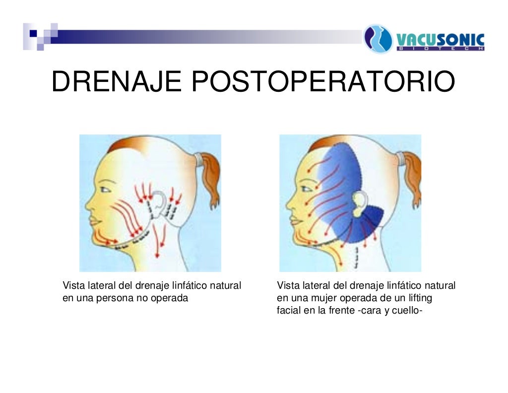 Masaje Drenaje LinfÃ¡tico Facial Casero Masaje Linfatico Cuello 2025