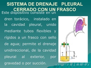 Este dispositivo consiste en un
dren torácico, instalado en
la cavidad pleural, unido
mediante tubos flexibles y
rígidos a un frasco con sello
de agua; permite el drenaje
unidireccional, de la cavidad
pleural al exterior, por
gravedad o por succión.
SISTEMA DE DRENAJE PLEURAL
CERRADO CON UN FRASCO
 