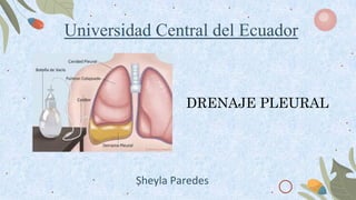 Universidad Central del Ecuador
DRENAJE PLEURAL
Sheyla Paredes
 