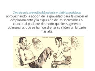 Consiste en la colocación del paciente en distintas posiciones
aprovechando la acción de la gravedad para favorecer el
desplazamiento y la expulsión de las secreciones al
colocar al paciente de modo que los segmento
pulmonares que se han de drenar se sitúen en la parte
más alta.
 