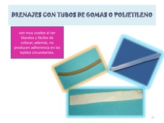 13DRENAJE A BAJA PRESIONREDONTubo de polivinilo o silicona