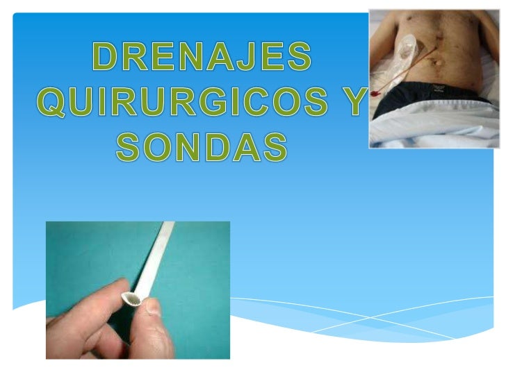 Tipos de drenajes quirurgicos pdf