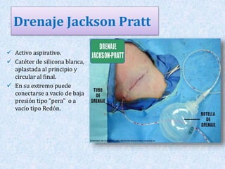 Drenaje Jackson Pratt 
 Activo aspirativo. 
 Catéter de silicona blanca, 
aplastada al principio y 
circular al final. 
 En su extremo puede 
conectarse a vacío de baja 
presión tipo "pera" o a 
vacío tipo Redón. 
 