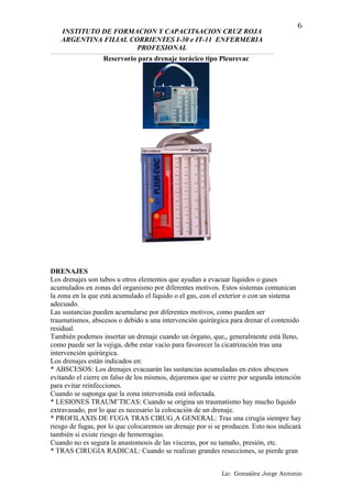 INSTITUTO DE FORMACION Y CAPACIT6ACION CRUZ ROJA
ARGENTINA FILIAL CORRIENTES I-30 e IT-11 ENFERMERIA
PROFESIONAL
Reservorio para drenaje torácico tipo Pleurevac
DRENAJES
Los drenajes son tubos u otros elementos que ayudan a evacuar líquidos o gases
acumulados en zonas del organismo por diferentes motivos. Estos sistemas comunican
la zona en la que está acumulado el líquido o el gas, con el exterior o con un sistema
adecuado.
Las sustancias pueden acumularse por diferentes motivos, como pueden ser
traumatismos, abscesos o debido a una intervención quirúrgica para drenar el contenido
residual.
También podemos insertar un drenaje cuando un órgano, que,, generalmente está lleno,
como puede ser la vejiga, debe estar vacío para favorecer la cicatrización tras una
intervención quirúrgica.
Los drenajes están indicados en:
* ABSCESOS: Los drenajes evacuarán las sustancias acumuladas en estos abscesos
evitando el cierre en falso de los mismos, dejaremos que se cierre por segunda intención
para evitar reinfecciones.
Cuando se suponga que la zona intervenida está infectada.
* LESIONES TRAUM˘TICAS: Cuando se origina un traumatismo hay mucho líquido
extravasado, por lo que es necesario la colocación de un drenaje.
* PROFILAXIS DE FUGA TRAS CIRUG¸A GENERAL: Tras una cirugía siempre hay
riesgo de fugas, por lo que colocaremos un drenaje por si se producen. Esto nos indicará
también si existe riesgo de hemorragias.
Cuando no es segura la anastomosis de las vísceras, por su tamaño, presión, etc.
* TRAS CIRUGIA RADICAL: Cuando se realizan grandes resecciones, se pierde gran
Lic. González Jorge Antonio
6
 