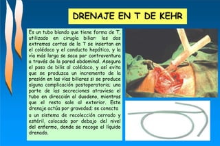 DRENAJE EN T DE KEHR
Es un tubo blando que tiene forma de T,
utilizado en cirugía biliar: los dos
extremos cortos de la T se insertan en
el colédoco y el conducto hepático, y la
vía más larga se saca por contraventura
a través de la pared abdominal. Asegura
el paso de bilis al colédoco, y así evita
que se produzca un incremento de la
presión en las vías biliares si se produce
alguna complicación postoperatoria; una
parte de las secreciones atraviesa el
tubo en dirección al duodeno, mientras
que el resto sale al exterior. Este
drenaje actúa por gravedad; se conecta
a un sistema de recolección cerrado y
estéril, colocado por debajo del nivel
del enfermo, donde se recoge el líquido
drenado.
 