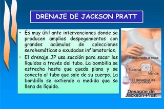 • Es muy útil ante intervenciones donde se
producen amplios despegamientos con
grandes acúmulos de colecciones
serohemáticas o exudados inflamatorios.
• El drenaje JP usa succión para sacar los
líquidos a través del tubo. La bombilla se
estrecha hasta que queda plana y se
conecta al tubo que sale de su cuerpo. La
bombilla se extiende a medida que se
llena de líquido.
DRENAJE DE JACKSON PRATT
 