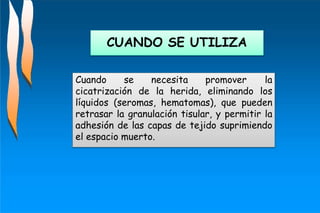 Cuando se necesita promover la
cicatrización de la herida, eliminando los
líquidos (seromas, hematomas), que pueden
retrasar la granulación tisular, y permitir la
adhesión de las capas de tejido suprimiendo
el espacio muerto.
CUANDO SE UTILIZA
 