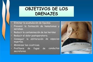 OBJETIVOS DE LOS
DRENAJES
de espacios
conductos
• Eliminar la acumulación de líquidos.
• Prevenir la formación de hematomas y
seromas.
• Reducir la contaminación de las heridas
• Reducir el dolor postoperatorio.
• Conseguir la obliteración
muertos.
• Minimizar las cicatrices.
• Profilaxis de fugas de
secretores.
 