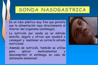 • Es un tubo plástico muy fino que permite
que la alimentación vaya directamente al
interior del organismo (estómago).
• La nutrición por sonda es un método
sencillo, seguro y eficaz que ayudará a
conseguir y mantener un correcto estado
nutricional.
• Además de nutrición, también se utiliza
para aplicar medicamentos y
descomprimir el estómago en caso de
distensión abdominal.
 