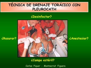 TÉCNICA DE DRENAJE TORÁCICO CON
               PLEUROCATH

                ¿Desinfectar?




¿Rasurar?                                        ¿Anestesiar?




                ¿Campo estéril?
            Carlos Piquer - Montserrat Figuera
 