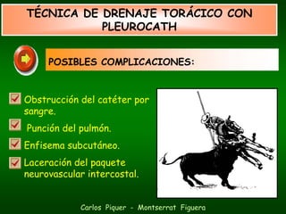 TÉCNICA DE DRENAJE TORÁCICO CON
           PLEUROCATH


     POSIBLES COMPLICACIONES:


Obstrucción del catéter por
sangre.
Punción del pulmón.
Enfisema subcutáneo.
Laceración del paquete
neurovascular intercostal.


            Carlos Piquer - Montserrat Figuera
 