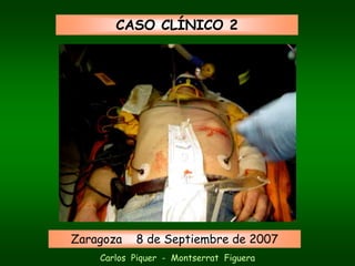 CASO CLÍNICO 2




Zaragoza   8 de Septiembre de 2007
    Carlos Piquer - Montserrat Figuera
 