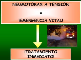 NEUMOTÓRAX A TENSIÓN

                  =
  ¡EMERGENCIA VITAL!




    ¡TRATAMIENTO
        INMEDIATO!
   Carlos Piquer - Montserrat Figuera
 