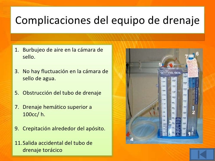 Drenaje Sello De Agua Pdf