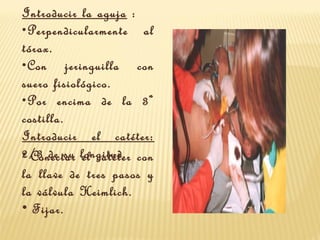 Introducir la aguja :
•Perpendicularmente al
tórax.
•Con jeringuilla con
suero fisiológico.
•Por encima de la 3ª
costilla.
Introducir el catéter:
2/3 de su longitud.• Conectar el catéter con
la llave de tres pasos y
la válvula Heimlich.
• Fijar.
 