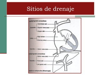 Sitios de drenaje
 